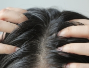Can Hair Replacement Treatments Be Done on Sensitive Scalp Skin?